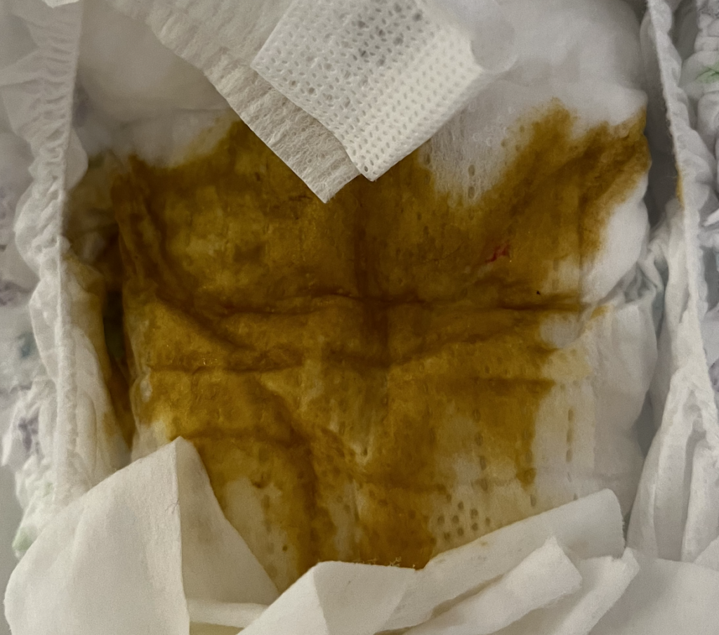 Hyperlactation speck of blood upper right